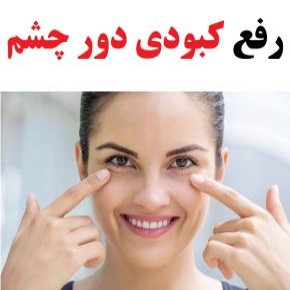 رفع کبودی دور چشم