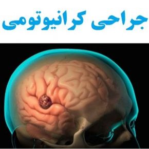 کرانیوتومی