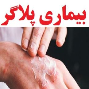 بیماری پلاگر