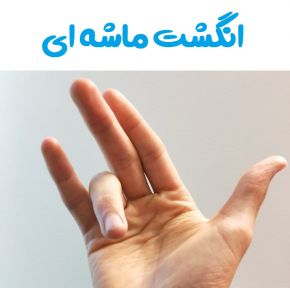درمان انگشت ماشه ای(تریگر فینگر) در طب سنتی