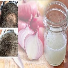 خواص ، فواید و مزایای آب پیاز چیست؟ + درمان ریزش مو