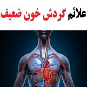 گردش خون ضعیف