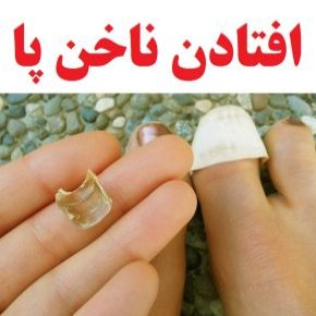علت و علائم افتادن ناخن پا و درمان آن + پیشگیری