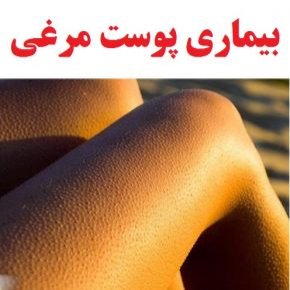 بیماری پوست مرغی