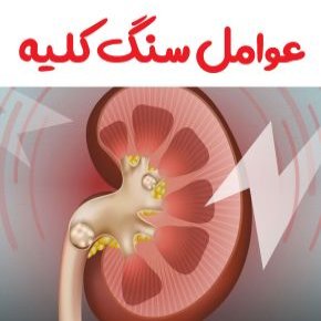 چه عواملی باعث تشکیل سنگ کلیه میشود؟