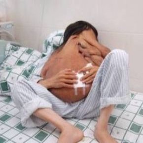 زشت ترین مرد جهان