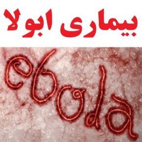 بیماری ابولا