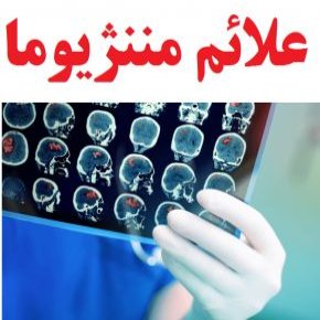 مننژیوما