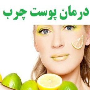 درمان خانگی پوست های چرب