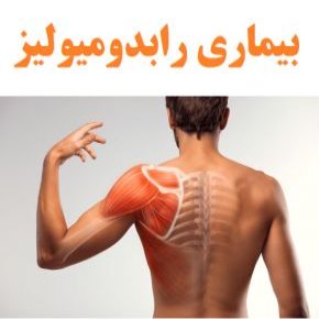 بیماری رابدومیولیز