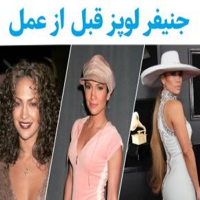 جنیفر لوپز قبل از عمل