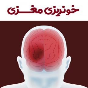 خونریزی مغزی