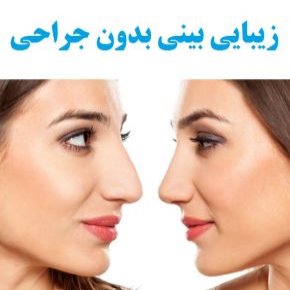 زیبایی بینی بدون جراحی