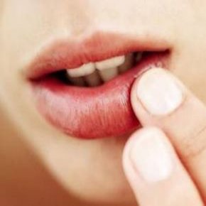بهترین راه برای خلاصی از کبودی لب ها