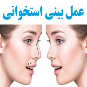 عمل بینی استخوانی