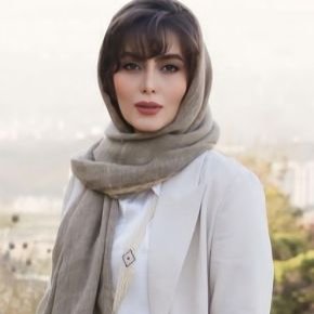 هدیه بازوند قبل عمل زیبایی