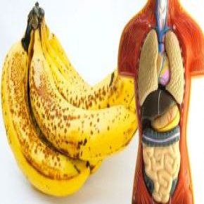 فواید و خواص معجزه آسای موز خالدار برای سلامتی + 10 خاصیت