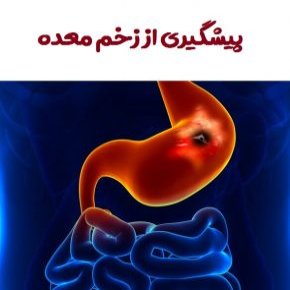 پیشگیری از زخم معده