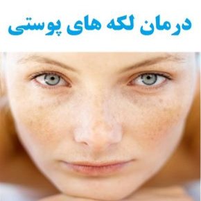لکه های پوستی