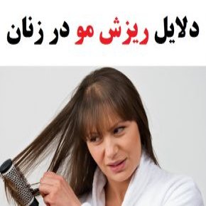 دلیل ریزش موی زنان