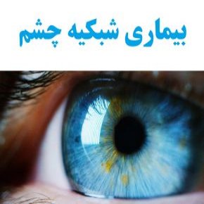علت و علائم انواع بیماری شبکیه چشم و درمان آن