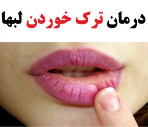 درمان ترک خوردن لبها با 9 روغن خانگی