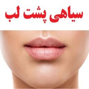 سیاهی پشت لب