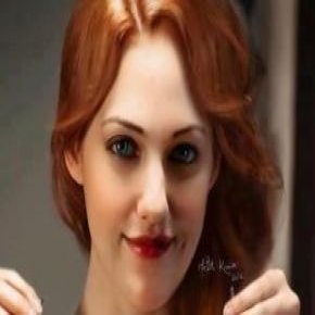 فاجعه بوتاکس صورت خرم سلطان