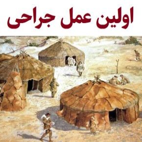 اولین عمل جراحی