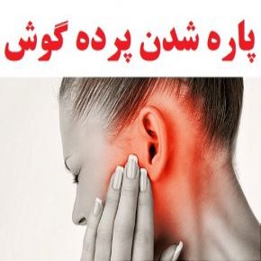 علت و علائم پاره شدن پرده گوش و درمان آن