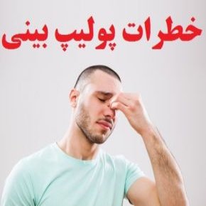 پولیپ بینی