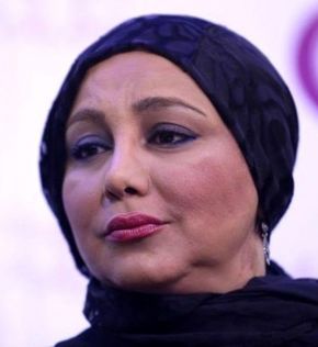 قیافه بهنوش بختیاری قبل از عمل بینی + عکس