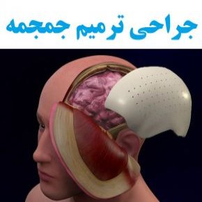 جراحی ترمیم جمجمه