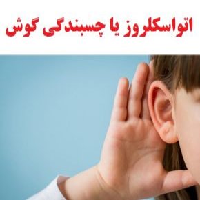 اوتواسکلروز