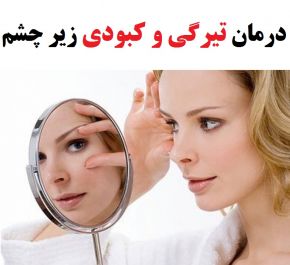 تیرگی و کبودی زیر چشم از علت تا درمان طبیعی و خانگی آن