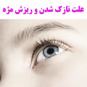 علل نازک شدن و ریزش مژه