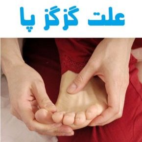 گزگز پا