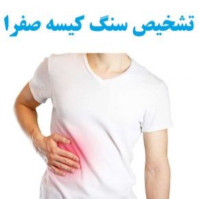 تشخیص سنگ کیسه صفرا