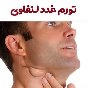 تورم غدد لنفاوی