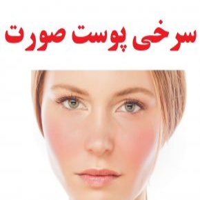 سرخی پوست صورت
