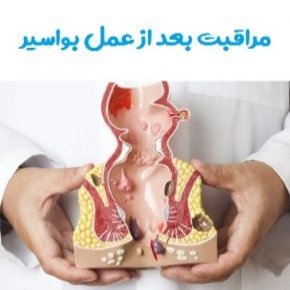 مراقبت بعد عمل بواسیر