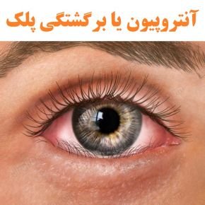 آنتروپیون