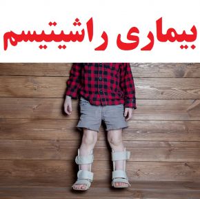 علت و علائم راشیتیسم(نرمی استخوان) و درمان آن