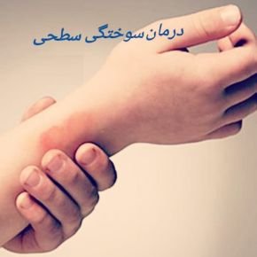 بعد از سوختگی چه باید کرد؟