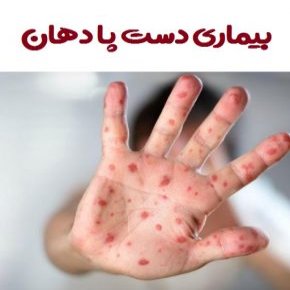 ویروس کوکساکی